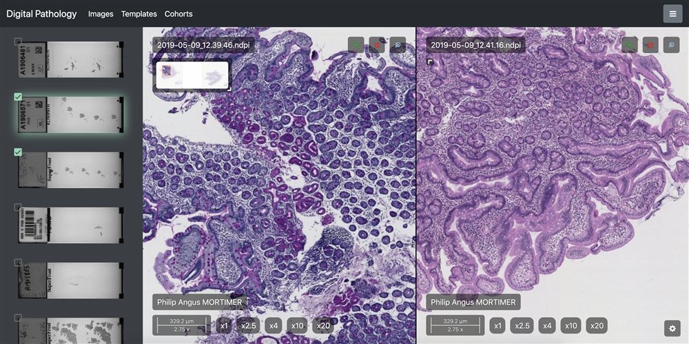 Digitale Pathologie