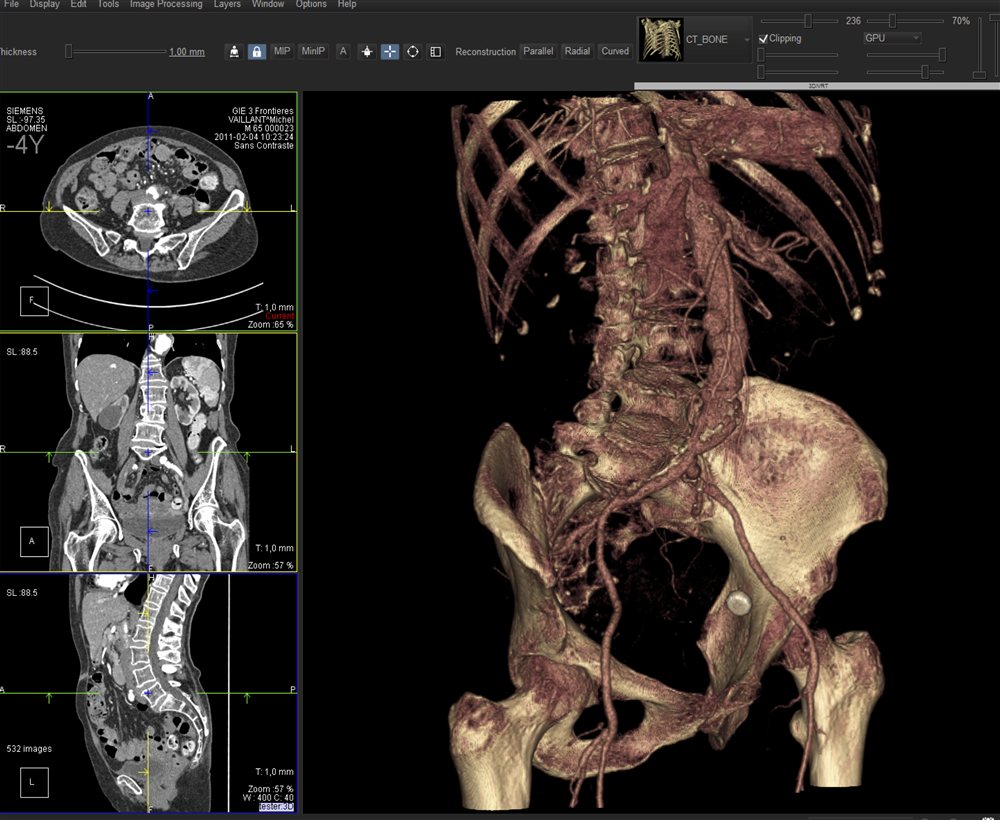 Telemis PACS 4.98: Breaking Barriers in Medical Imaging Sharing